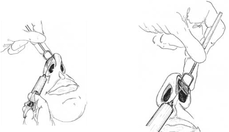 Lokal Anesteziya və Sedasyon